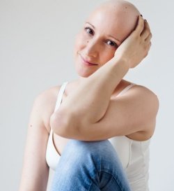 Med kemoterapijo je Darja seveda ostala brez las. (Foto: osebni arhiv)