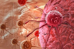 Za rak je značilna nenadzorovana celična delitev in sposobnost teh celic, da napadejo druga tkiva. (Ilustrativna fotografija; foto: Pixabay)